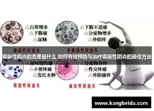 霉菌性阴炎的克星是什么 如何有效预防与治疗霉菌性阴炎的最佳方法